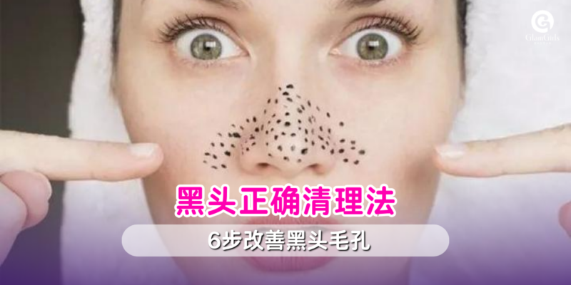 黑头正确清理法